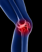 Joint Disorders