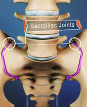 Sacroiliac Joint Disease