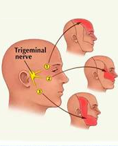 Sphenopalatine / Glossopharyngeal / Trigeminal Nerve Blocks