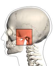 TMJ Disorders